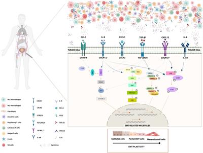 Tumor microenvironment and epithelial-mesenchymal transition in bladder cancer: Cytokines in the game?